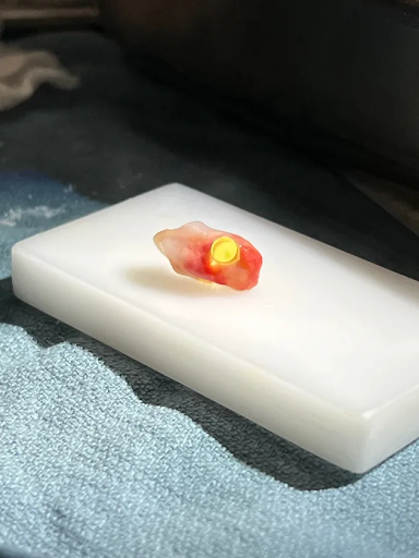 The shaved tooth, embedded with a plastic optical cylinder