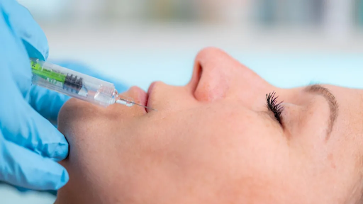 A close-up view of a person receiving a dermal filler injection in the lip, administered by a gloved medical professional using a syringe.
